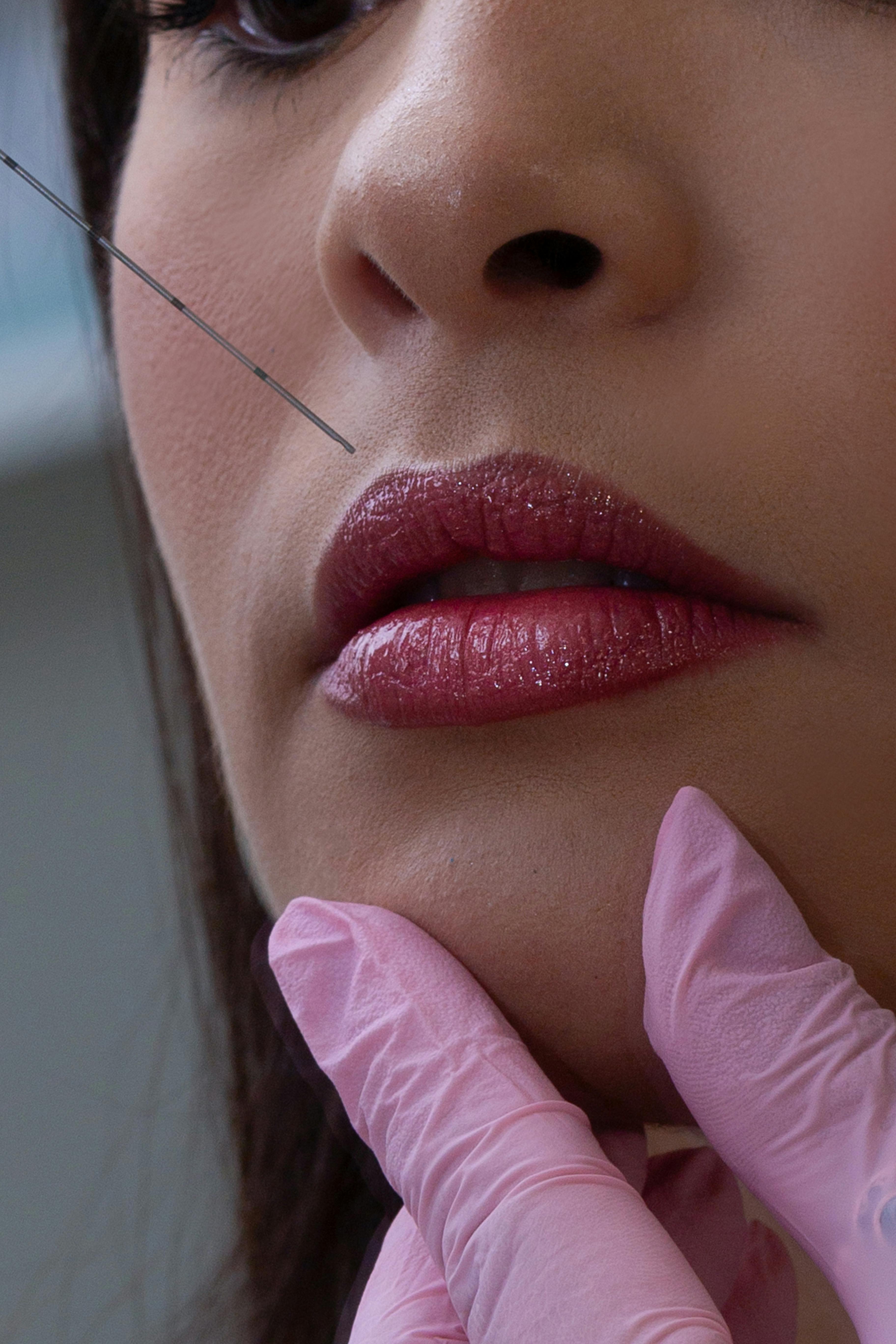 Top Lip Filler Injectors near Washington, DC